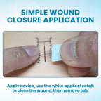 microMend Emergency Wound Closures - Surgical-Grade Laceration Repair Without Stitches | Skin Closure Alternative to Butterfly Bandages | First Aid Kit Essential (6 Medium Wound Closure Devices)