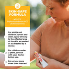 After Bite Xtra Formula - Itch Relief with Diphenhydramine HCl - Ideal for Mosquito & Fire Ant Bites, Bees & More - Portable Gel Formula - 0.7 oz (4 Pack)