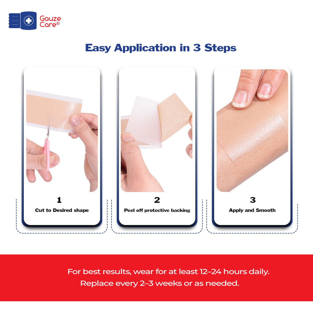 GauzeCare Silicone Scar Tape – 1.6”x150” Roll – Medical-Grade, Reusable, Professional Silicone Scar Tape for surgical scars, C-Section, Burns, Keloid, and Acne Scars