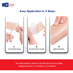 GauzeCare Silicone Scar Tape – 1.6”x150” Roll – Medical-Grade, Reusable, Professional Silicone Scar Tape for surgical scars, C-Section, Burns, Keloid, and Acne Scars