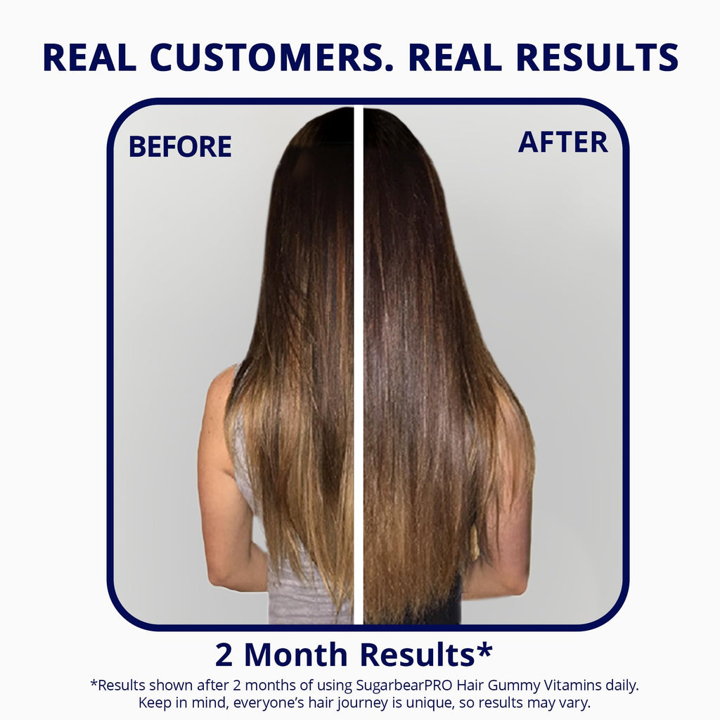 SugarBearPro Hair Vitamin Gummy 1 Month Supply, Extra Strength Biotin 6000mcg for Hair Growth, Vegan Vitamin B12, MSM, Inositol, Omega 3, Elderberry, Certified Kosher, Halal, Cruelty-Free