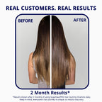 SugarBearPro Hair Vitamin Gummy 1 Month Supply, Extra Strength Biotin 6000mcg for Hair Growth, Vegan Vitamin B12, MSM, Inositol, Omega 3, Elderberry, Certified Kosher, Halal, Cruelty-Free
