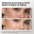 Skin Deva 20% Vitamin C Serum Anti Aging Face Serum with Hyaluronic Acid & Vitamin E – Brightening Formula for Improving Appearance of Dark Spots, Fine Lines & Wrinkles – All Skin Types, 1 fl oz