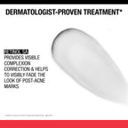 Neutrogena Retinol SA, Stubborn Marks PM Treatment, Face-Exfoliating Treatment to Help Reverse the Look of Post-Acne Marks & Uneven Skin Tone, Non-Comedogenic, PM Treatment, unscented, 1.0 Fl Oz