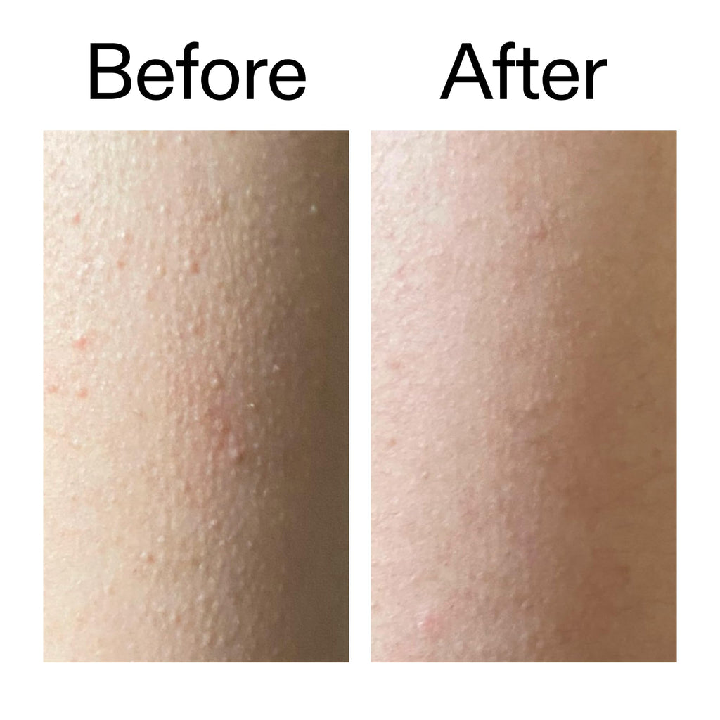 The INKEY List Glycolic Acid Exfoliating Body Stick 45g