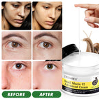 ITSDAWN 2 Pack Snail Mucin 92% Face Cream 100g, Moisturizer Hydrating Cream for Dry & Sensitive Skin, All Skin Types