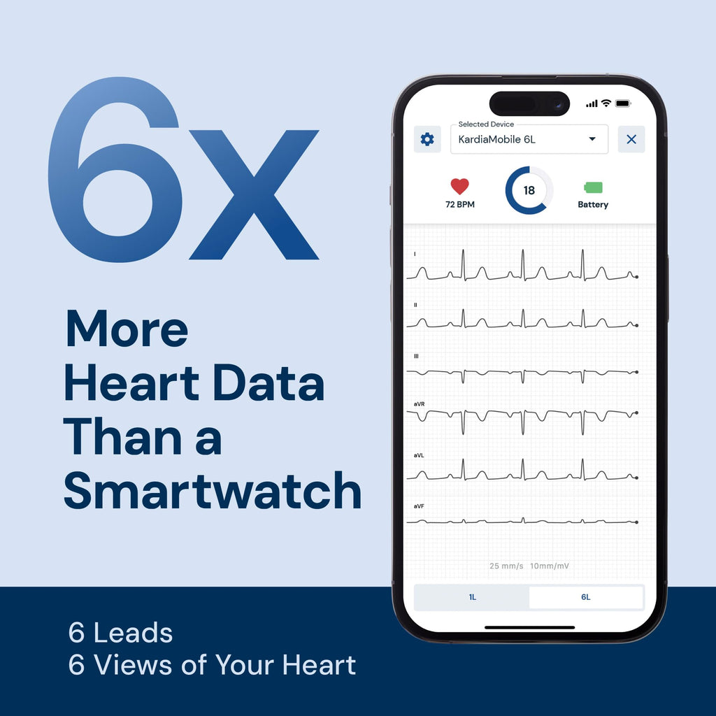 KardiaMobile 6L 6-lead EKG Heart Monitor, Medical-grade accuracy, HSA&FSA
