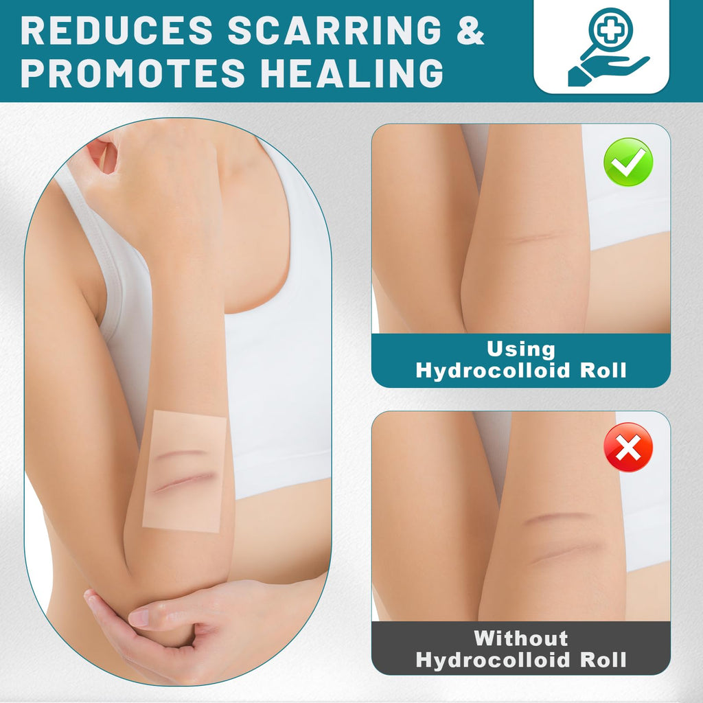 CUKWUYBY Hydrocolloid Roll for Wound Care, 2in*6.6ft Hydrocolloid Bandages
