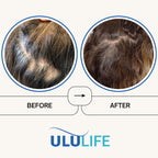 ULULIFE Ultimate Regrow Multivitamin: Promotes Hair Growth, Skin, & Nails Health - Ashwagandha & Resveratrol-Powered Solution for Hormone Support & Overall Health - 540 Capsules (90-Day Supply)