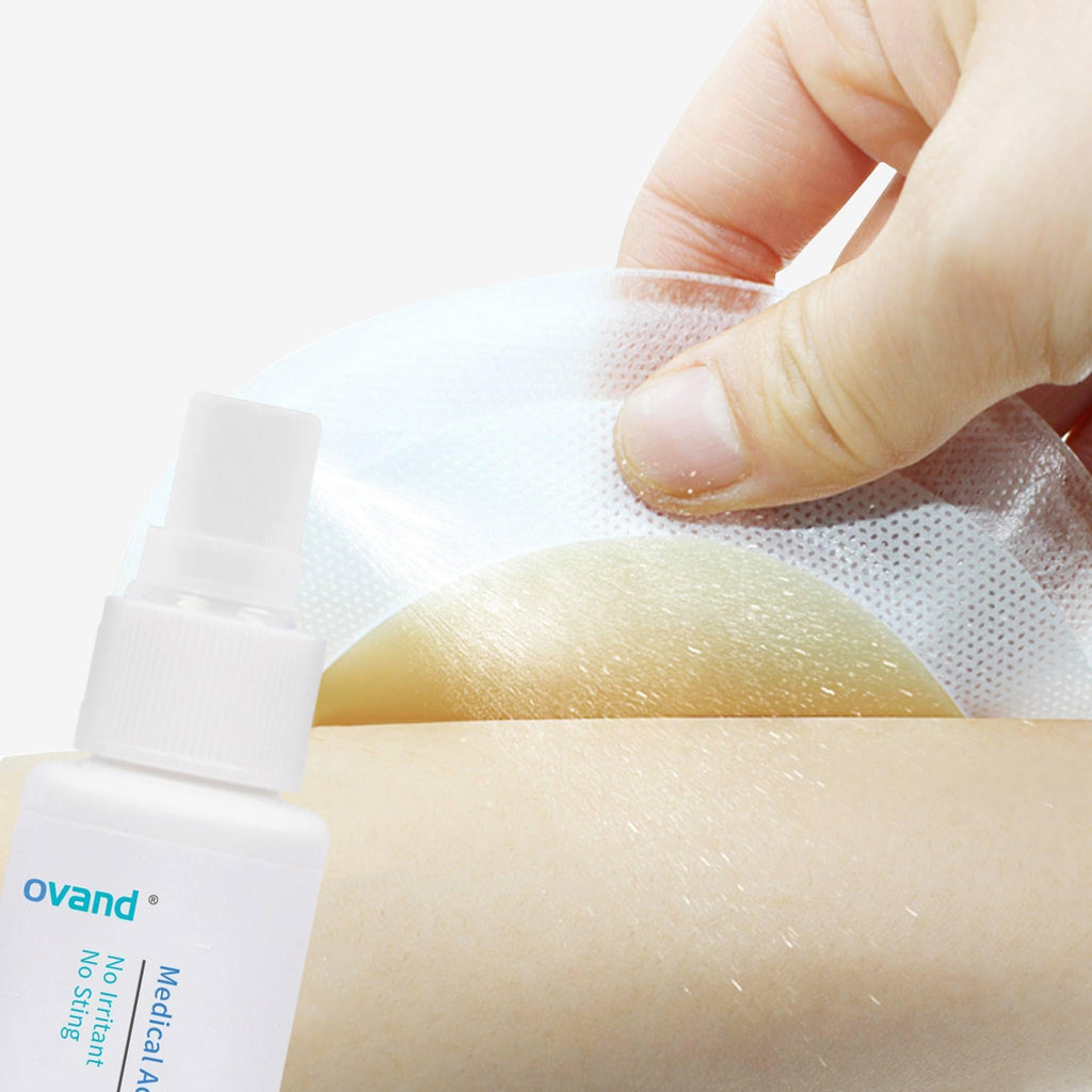 Medical Adhesive Remover Spray - 1 oz.No-Sting Ostomy Adhesive Remover Spray: Adhesive Remover for Skin,Ostomy,Mastectomy,Adhesive Tape