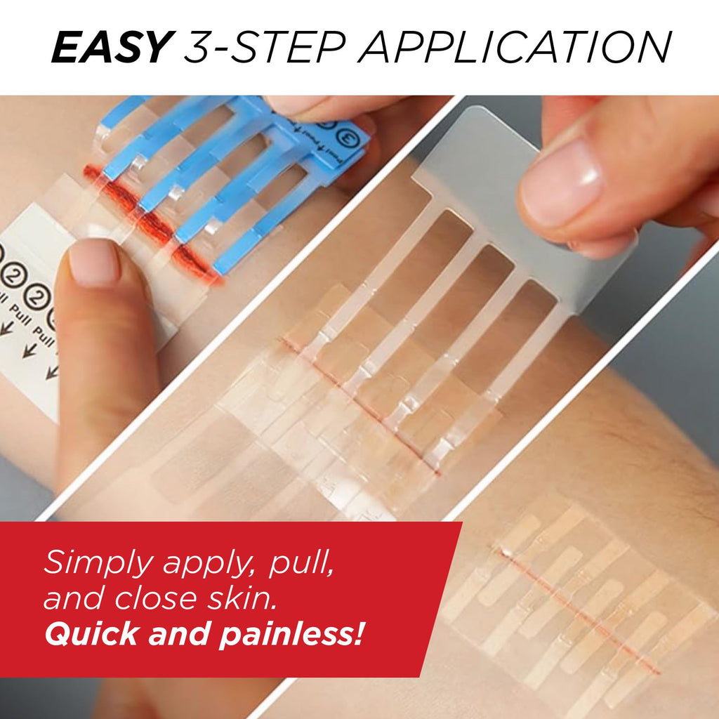 Clozex Emergency Laceration Closures - Repair Wounds Without Stitches, Skin Closure Device for 3 Individual Wounds Or Combine for Total Length of 4 1/4 Inches