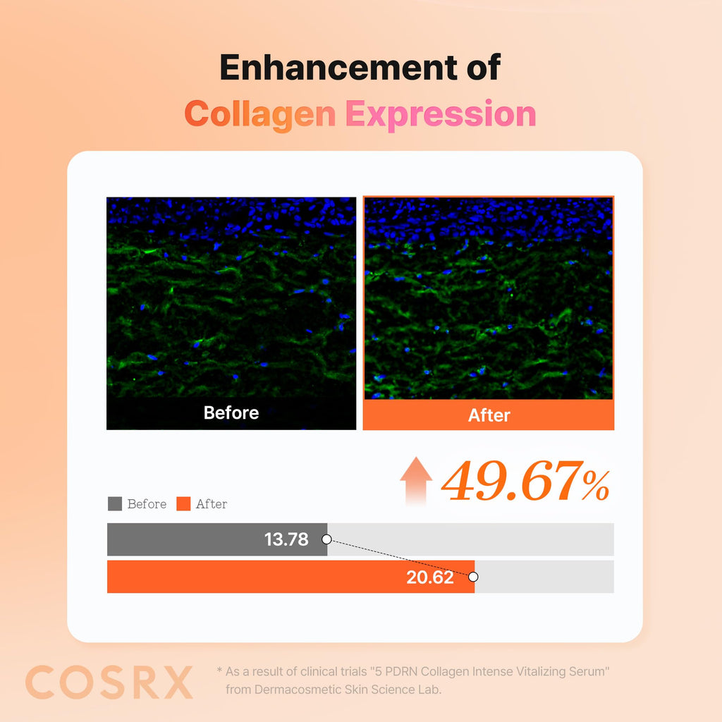 COSRX 5 PDRN Collagen Intense Vitalizing Serum - Korean Serum for Skin Firming & Glowing with Salmon DNA, Centella, Lactobacillus PDRN & Collagen, Korean Skin Care (3.38 fl.oz.)