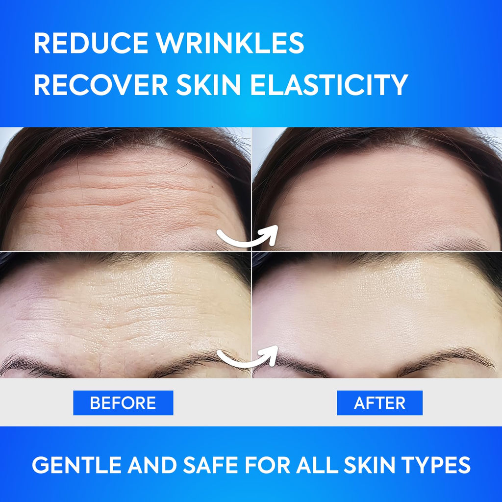 SILKDERMIS Forehead Wrinkle Patches 12Pcs with Aloe, Collagen, Vitamin E, Anti Wrinkle Patches, Forehead Wrinkles Treatment