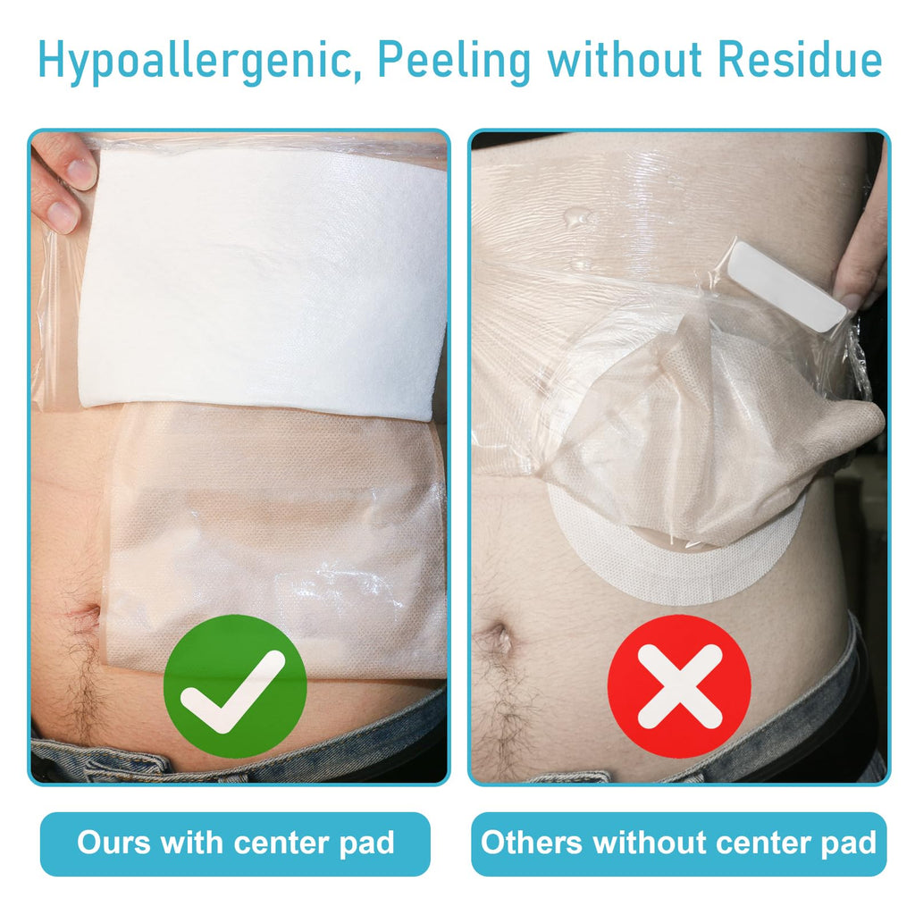 KONWEDA 25 Pcs Waterproof Ostomy Bag Shower Cover 10"x10", Stoma Bath Protector Shield Film Adhesive Dressing Bandage for Ostomy Supply Guard Accessory