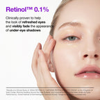 Anua Retinol 0.1 Caffeine Revitalizing Eye Cream, Lightweight Formula for Dark Circles & Puffiness, Hydrating for Sensitive Skin, Korean Skincare,1.05 fl oz