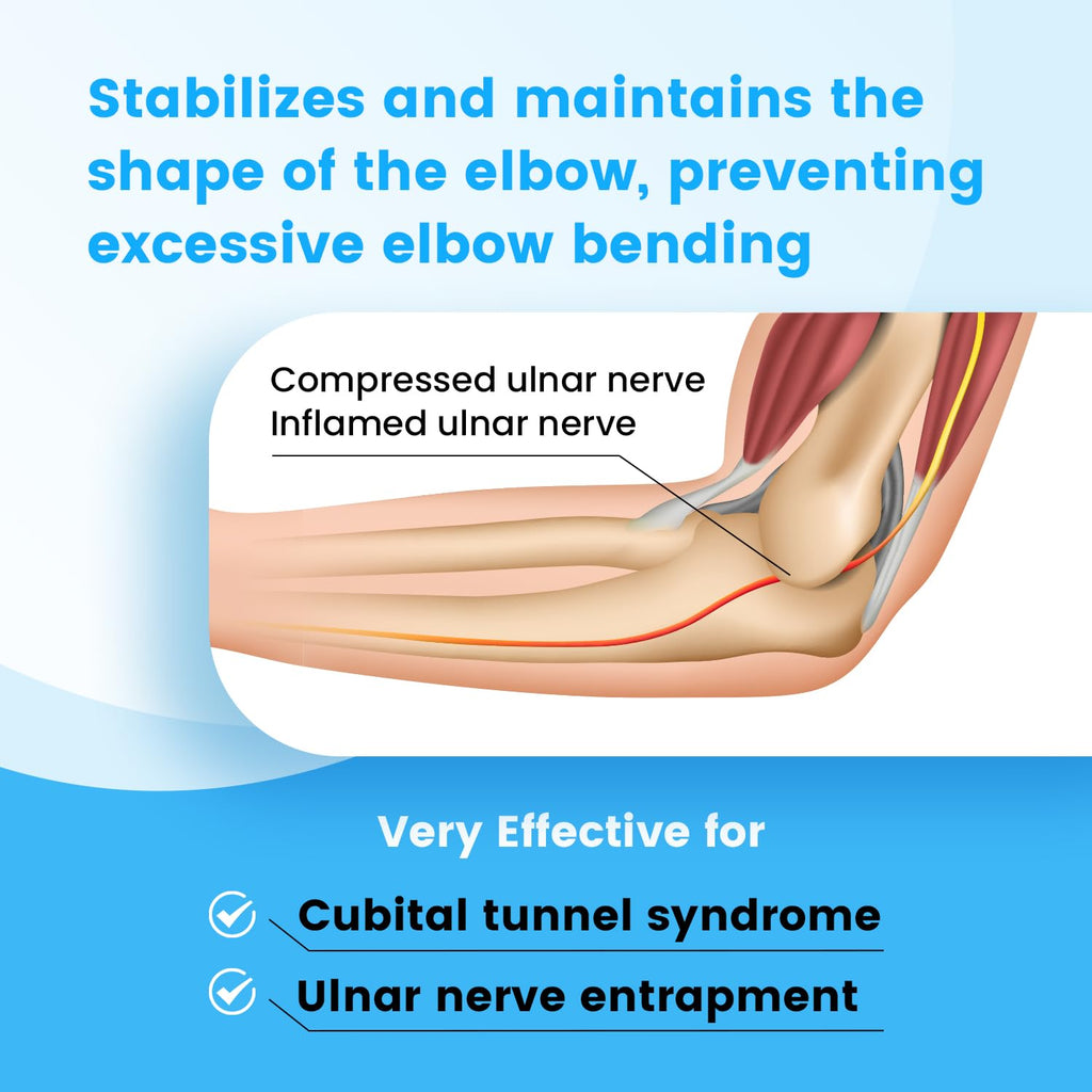 Cubital Tunnel Syndrome Elbow Brace, Ulnar Nerve Entrapment Splint, Elbow Immobilizer for Night Sleeping and Day Working, 4 Angles Adjustable, Fit Women & Men, Right & Left Arm - L/XL