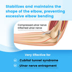 Cubital Tunnel Syndrome Elbow Brace, Ulnar Nerve Entrapment Splint, Elbow Immobilizer for Night Sleeping and Day Working, 4 Angles Adjustable, Fit Women & Men, Right & Left Arm - L/XL