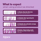 Women's Rogaine 5% Minoxidil Topical Foam, Unscented, 2 x 2.11 oz