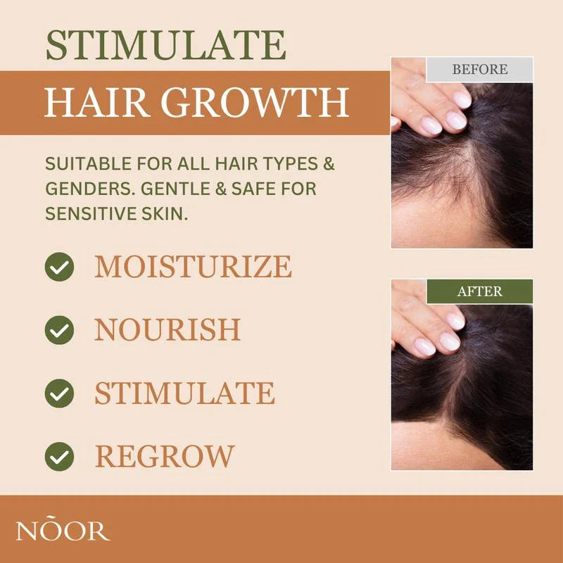 Noor Hair Rosemary Growth Spray - Hair Growth with Rosemary, Green coffee bean, Biotin, Cynatine Keratin, and MCT Oil from Palm Leaves - Thicker Hair - Scalp Itchiness Relief -  2 FL Haircare Nourishing