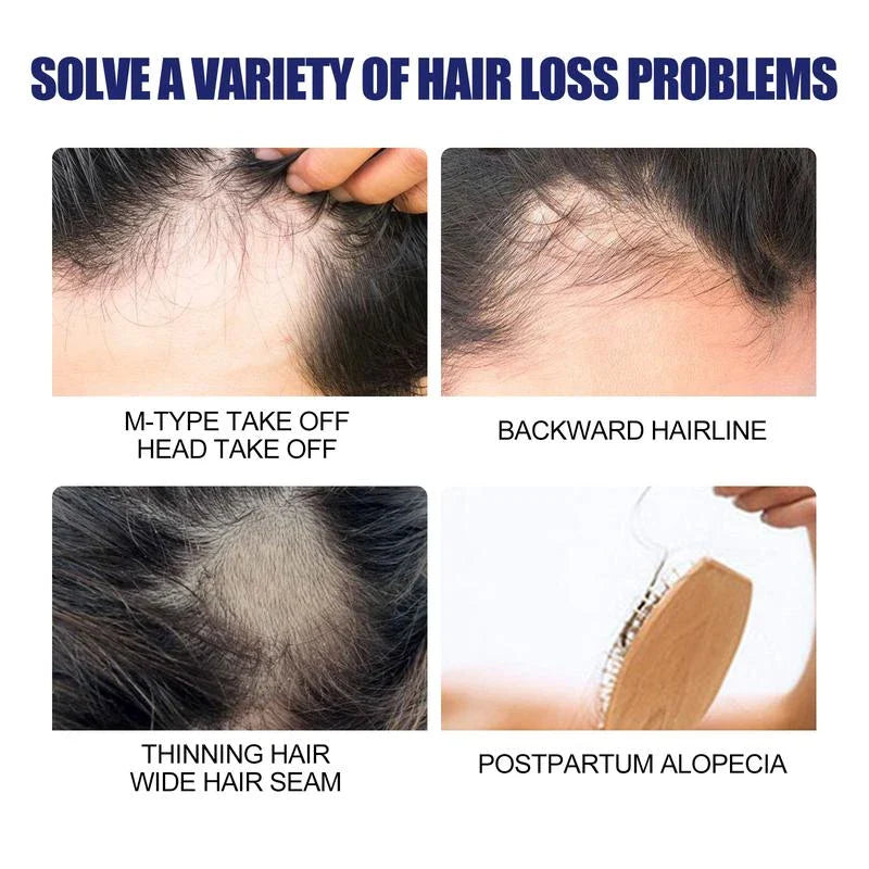 East Moon Men'S Hair Thickening Foam | Plant-Based Formula For Stronger Strands & Scalp Nourishment