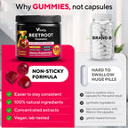 VitaUp Beet Root Gummies – Beetroot Gummies with CoQ10, Grape Seed, Vitamin C, B12 & B3 – Nitric Oxide Gummies for Circulation Support – Beet Supplement for Energy & Immune Support – 120 Beets Chews