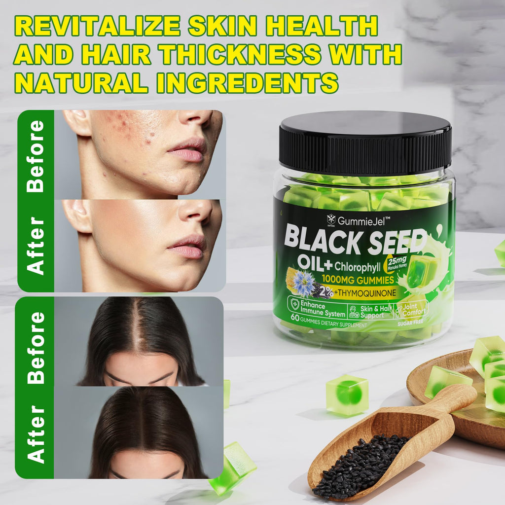 Black Seed Oil Gummies & Chlorophyll, Biotin 500mcg with Hydrolyzed Collagen, Raw Manuka Honey, Organic Cold Pressed - Ultimate Absorption for Skin, Hair & Nails, Digestive, Overall Health, 1 Pack