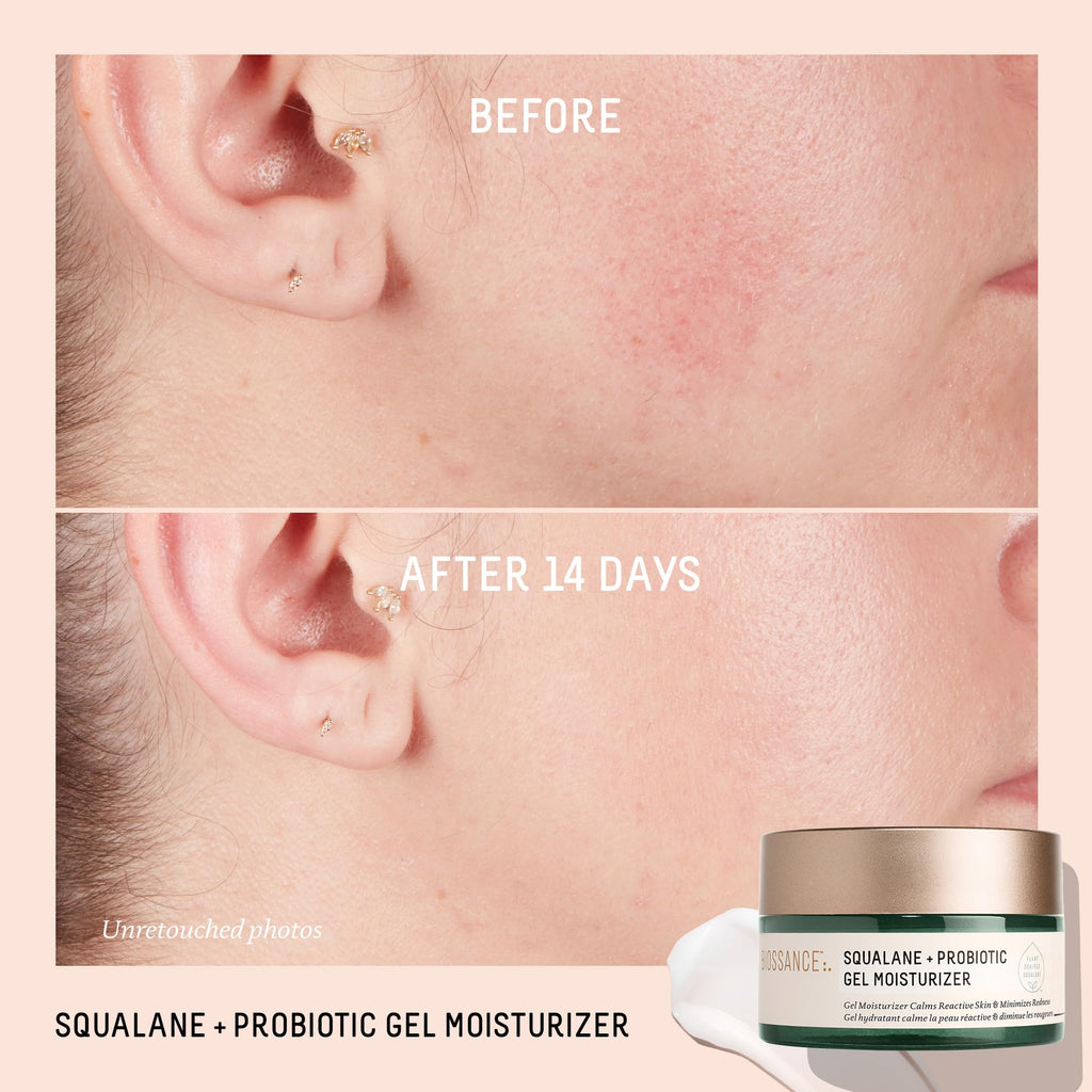 Biossance Squalane + Probiotic Balancing Face Gel Moisturizer - Advanced Formula for Oily & Acne-Prone Skin, Encapsulated Probiotics, Reduces Redness & Excess Oil, Soothes Sensitive Skin - 1.69 oz