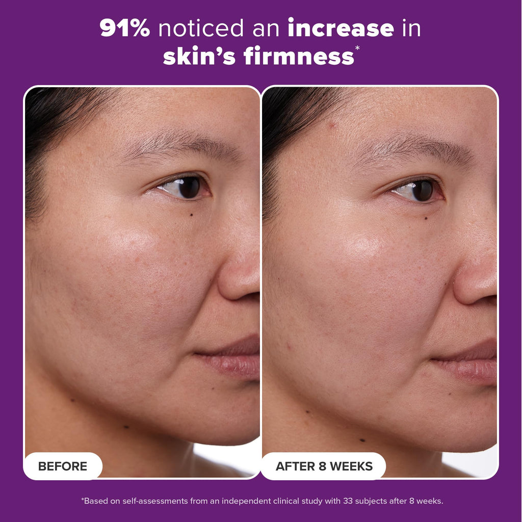 Paula's Choice CLINICAL 1% Retinol Treatment Cream with Peptides, Vitamin C & Licorice Extract, Anti-Aging & Wrinkles, Travel Size. PACKAGING MAY VARY.