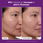 Paula's Choice CLINICAL 1% Retinol Face Treatment with Peptides, Vitamin C & Licorice Extract, Anti-Aging Skin Care Serum, Fine Lines & Wrinkles, Fragrance Free, 1 Fl Oz