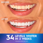 Crest 3D Whitestrips Professional Effects + LED Light – Teeth Whitening Kit, 1 Light + 20 Treatments, Each with 1 Upper/1Lower, 40 Strips – Crest 3DWhite Teeth Whitening Strips