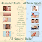 Beef Tallow for Skin - NAKED TALLOW BALM I 1 Ingredient - 100% Grass Fed Beef Tallow | Whole Body & Face | Whipped & UNSCENTED for Sensititve Dry Skin, Babies, Eczema, Psoriasis, Rosacea