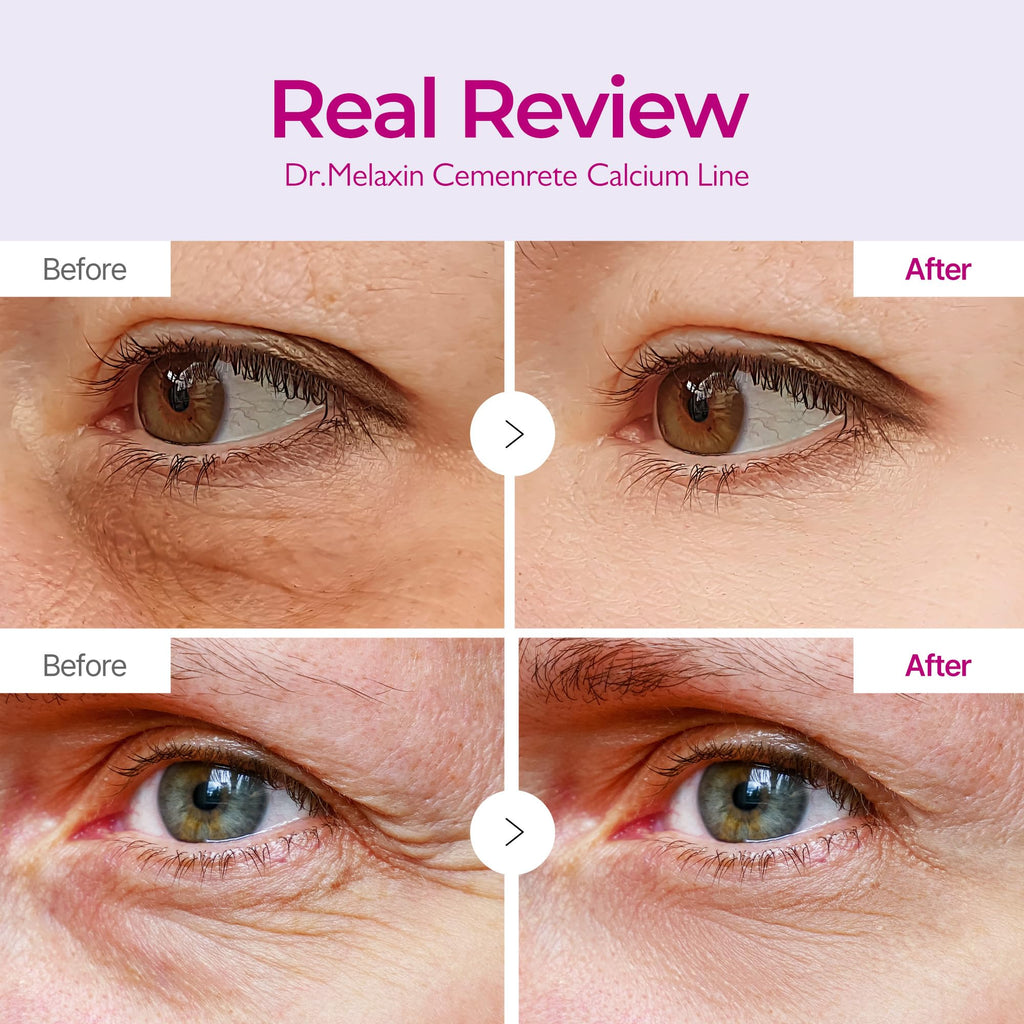 Dr.Melaxin Calcium Volume Eye Patches – Firming Hydrogel Under Eye Masks for Puffiness & Fine Lines, Deep Hydration, 60 Count