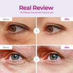 Dr.Melaxin Calcium Volume Eye Patches – Firming Hydrogel Under Eye Masks for Puffiness & Fine Lines, Deep Hydration, 60 Count