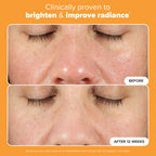 Paula's Choice BOOST C15 Super Booster, 15% Vitamin C Serum for Face, Face Serum with Vitamin E & Ferulic Acid for Discoloration & Glow, Fragrance-Free, 0.67 Fl Oz