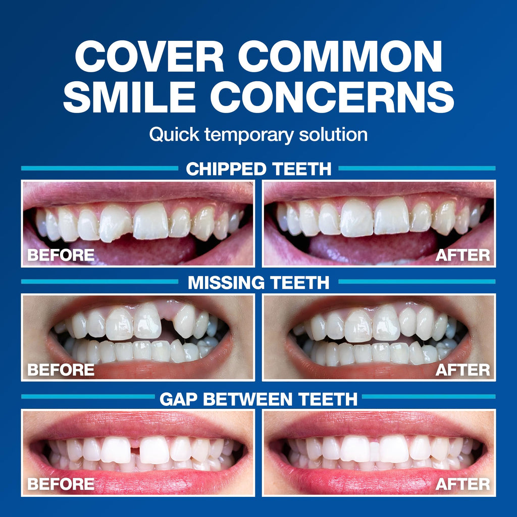 Imako Tooth Tinted Plastic - Natural Color - Temporary Tooth - Made in USA