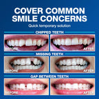 Imako Tooth Tinted Plastic - Natural Color - Temporary Tooth - Made in USA