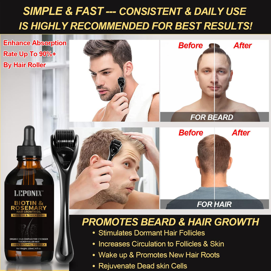 Rosemary Oil for Hair Growth, 120ml Diluted Rosemary Oil Hair Growth Serum with Derma Roller & Scalp Massager Hair Thickening Products Hair Loss Treatment for Men Women, Mens Gift Set