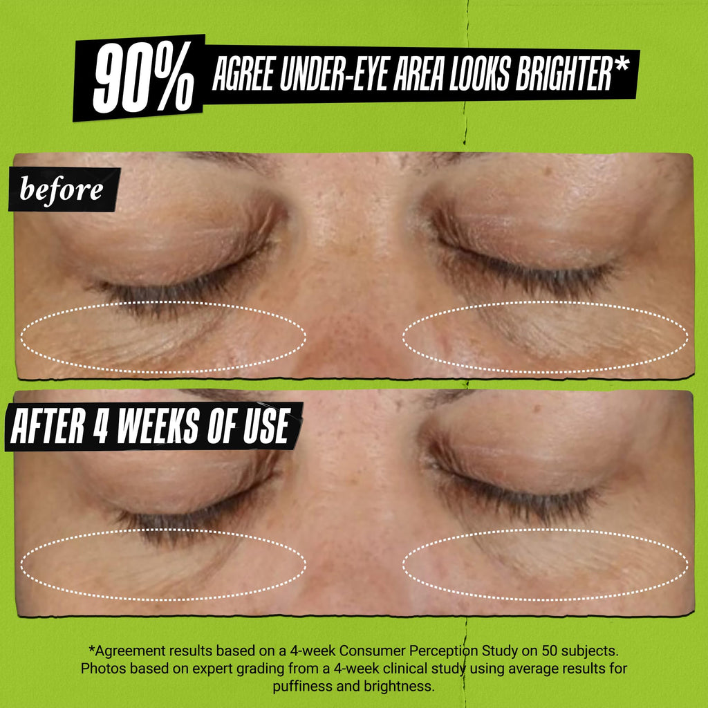 Kiehl's Avocado Eye Treatment, Nourishing and Hydrating Eye Cream, Avocado Oil and Caffeine to Energize and Invigorate Skin, Tired Eyes, 99% Naturally Derived Formula - 0.5 fl oz