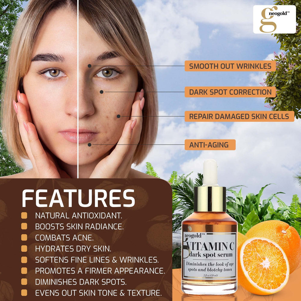 Neogold Brightening Vitamin C Face Serum Anti Aging Eye Serum | Fragrance Free Potent Vitamin C Face Moisturizer Facial Serum For Women, Acne, Dark Spot Treatment, Wrinkles, Uneven Skin Tone, 2 Fl Oz