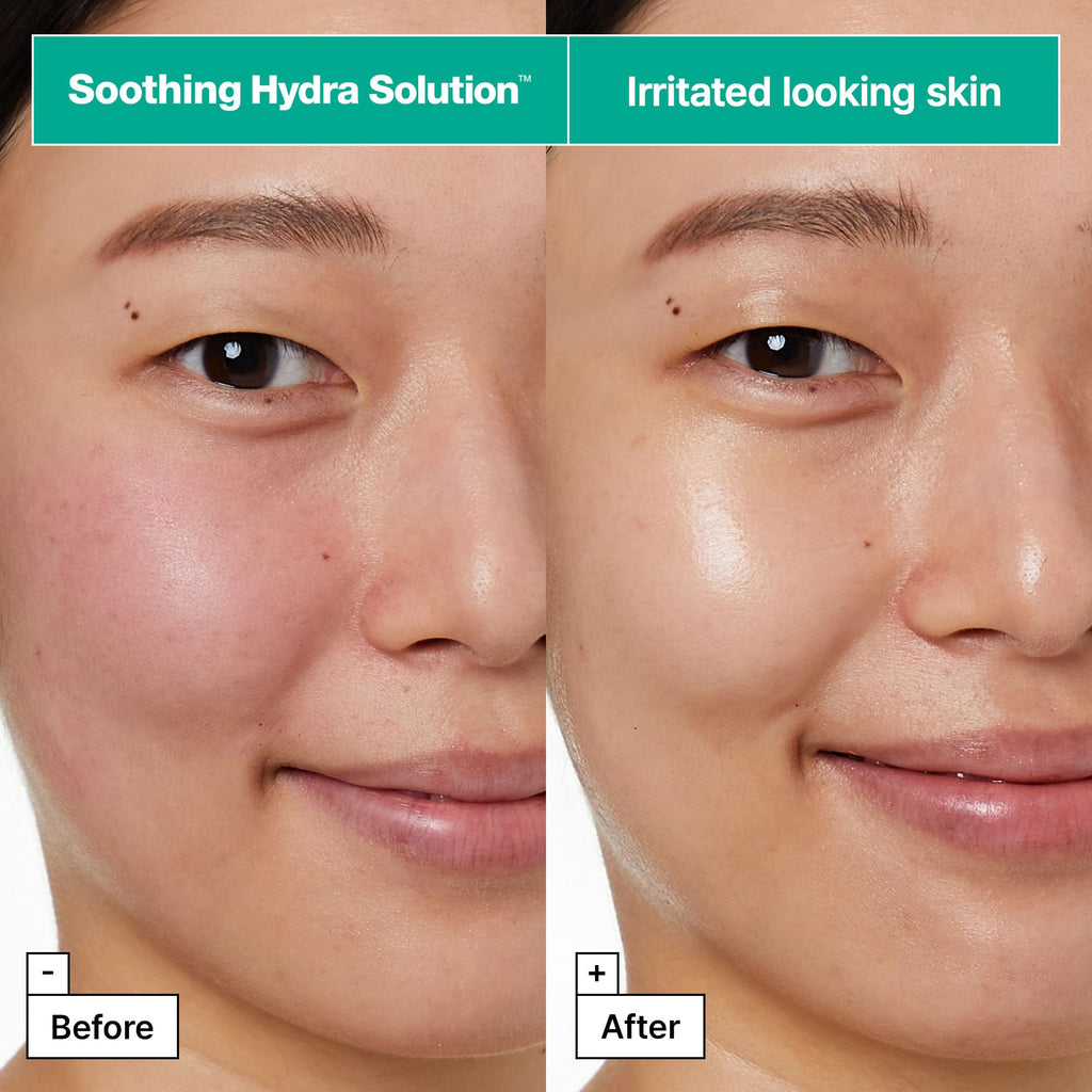 Dr.Jart+ Dermask Soothing Hydra Solution Korean Face Mask for Visibly Irritated Skin | Sheet Mask | Korean Skin Care, 5 Pack
