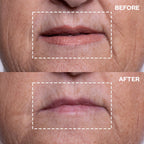 Wrinkles Schminkles Mouth & Lip Wrinkle Patch, 1-Pack, Reusable Hypoallergenic Medical Grad Silicone Smile Line Patches, Anti Wrinkle Sleep Patches for Lip Wrinkle Prevention