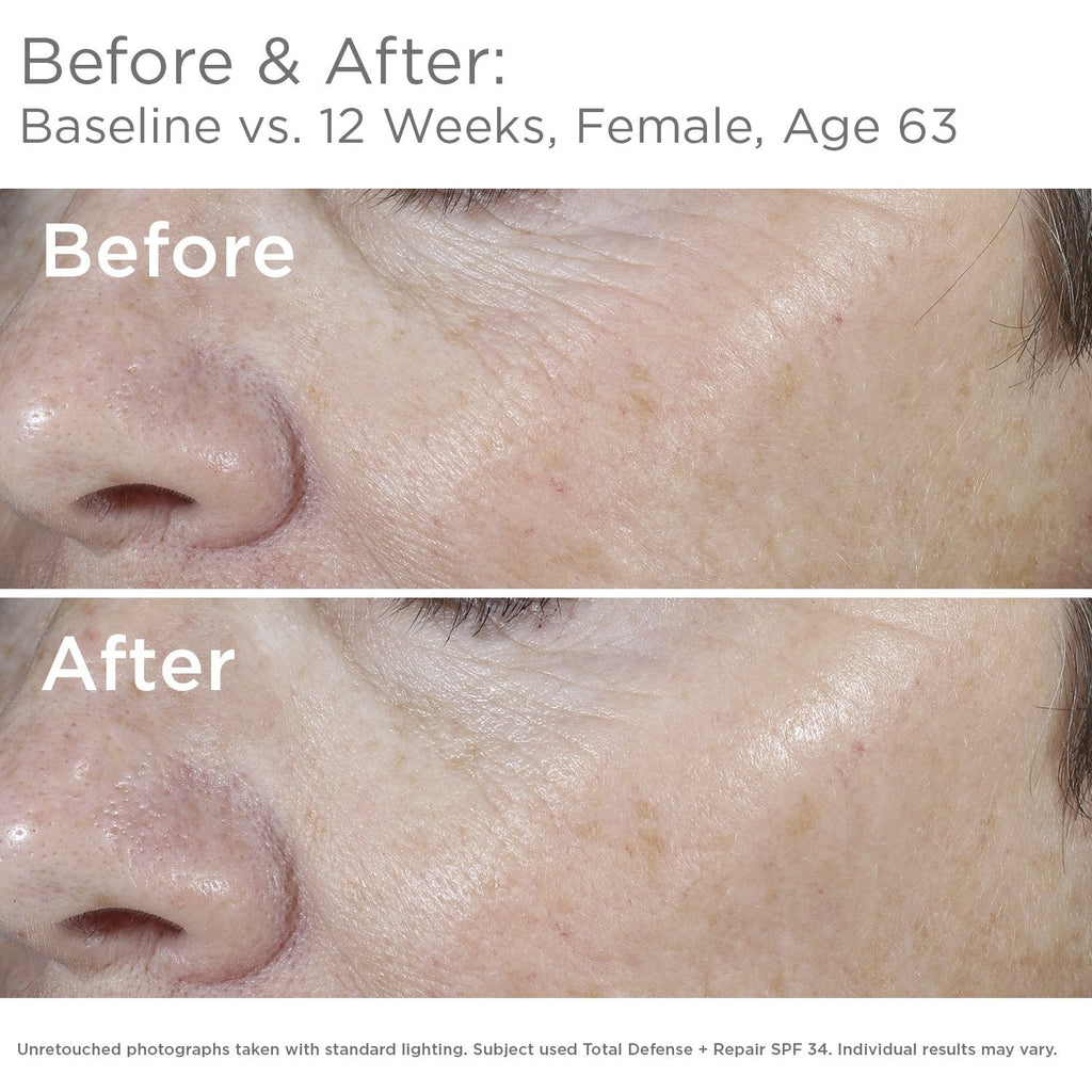 SkinMedica Total Defense + Repair SPF 34 Sunscreen for Face. This Lightweight, Facial Sunscreen is Ideal for Oily and/or Combination Skin, 2.3 Oz
