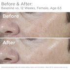 SkinMedica Total Defense + Repair SPF 34 Sunscreen for Face. This Lightweight, Facial Sunscreen is Ideal for Oily and/or Combination Skin, 2.3 Oz