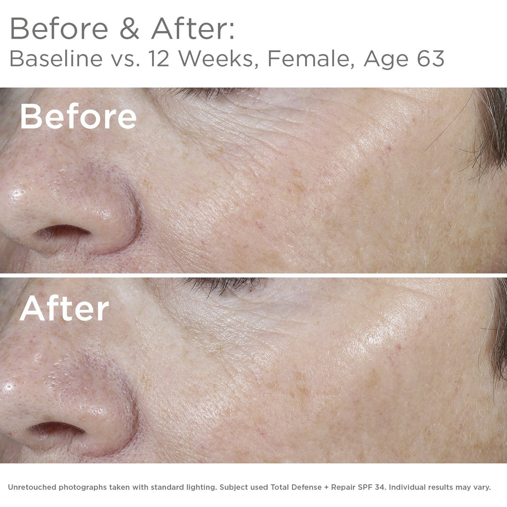 SkinMedica Total Defense + Repair SPF 34 Tinted Sunscreen for Face. This Lightweight, Facial Sunscreen is Ideal for Oily and/or Combination Skin, 2.3 Oz