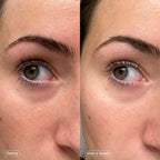 Topicals Faded Brightening Under Eye Masks | Patches to Depuff, Hydrate, Brighten and Cool | Reduce Dark Circles and Fine Lines | Contains Kojic Acid, Caffeine and Niacinamide (Set of 6)