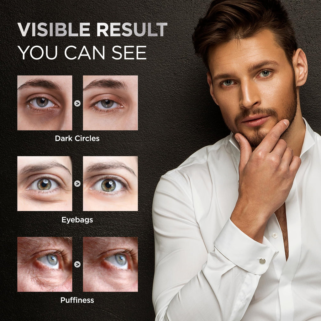 RAZONIX Eye Bags Treatment for Men: Caffeine Eye Roller for Puffy Eyes and Puffiness – Under Eye Cream for Dark Circles (Medium, Unscented)