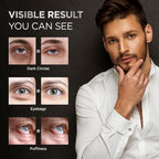 RAZONIX Eye Bags Treatment for Men: Caffeine Eye Roller for Puffy Eyes and Puffiness – Under Eye Cream for Dark Circles (Medium, Unscented)