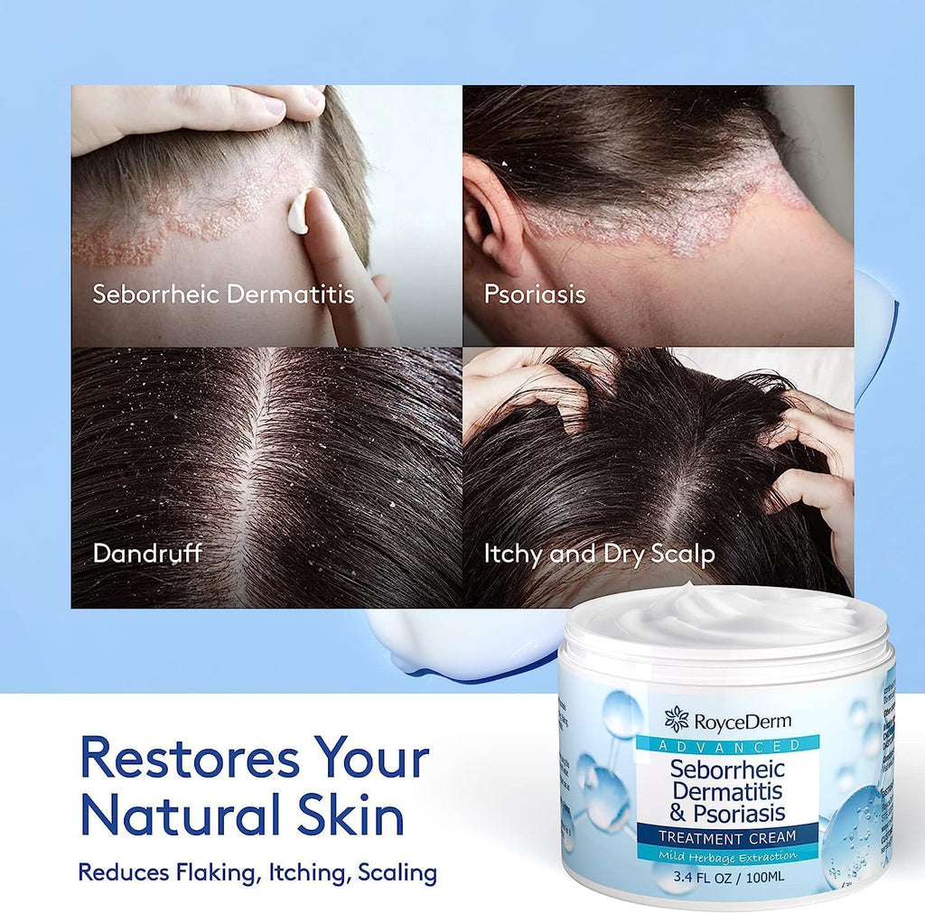 Roycederm Seborrheic Dermatitis Cream, Scalp Treatment for Psoriasis, Folliculitis, Dry Scalp, Dandruff, Anti-Itch Cream for Soothing Relief - 2 Pack