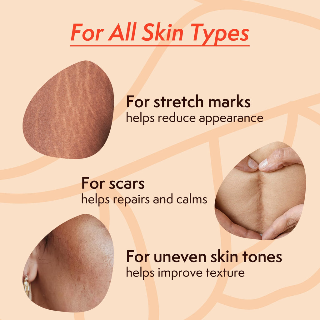 Nature Spell Stretch Mark Body Oil, Strengthens Skin Elasticity & Helps With the Appearance of Stretch Marks and Scars, Infused With Vitamin E, Vegan, 100ml