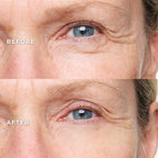 WUNDER2 Wunderlift Instant Eye Tightening Serum, Temporary Firming & Lifting Treatment in 60 Seconds, Reduces Under-Eye Bags, Dark Circles, Puffiness, Anti-aging Fine Lines